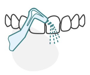 Dental Bonding Icon