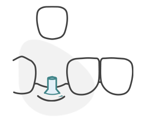 Dental Crown Icon