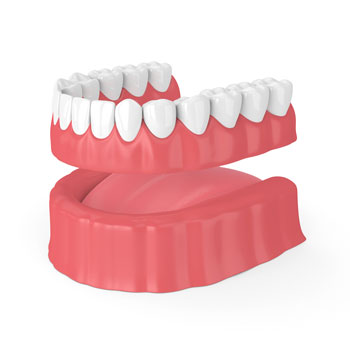 full-denture-set full-denture-set