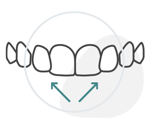Invisalign Icon